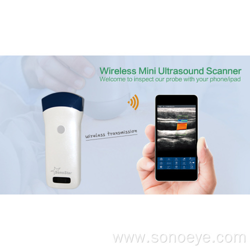 handheld wireless ultrasound for phone and pad